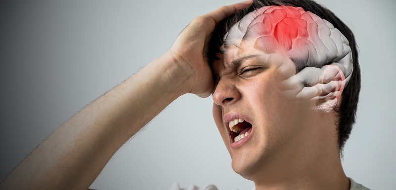Brain Stroke Concept, Headache, Cerebral Hemorrhage, 3d Rendering